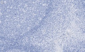 Anti-Cofilin-1 Antibody, clone 1C18 ZooMAb® Rabbit Monoclonal recombinant, expressed in HEK 293 cells