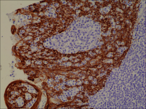 Anti-CK-5/CK-6 (Cytokeratin 5/ Cytokeratin 6) antibody, Rabbit monoclonal recombinant, expressed in HEK 293 cells, clone RM341, purified immunoglobulin