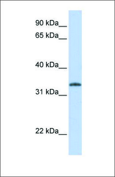 Anti-UCK2 antibody produced in rabbit affinity isolated antibody