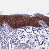 Anti-CLCA2 antibody produced in rabbit Prestige Antibodies® Powered by Atlas Antibodies, affinity isolated antibody, buffered aqueous glycerol solution
