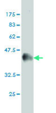 Monoclonal Anti-MCC antibody produced in mouse clone 1A7, purified immunoglobulin, buffered aqueous solution