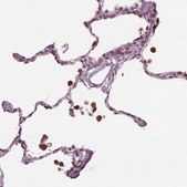 Anti-NUP210 antibody produced in rabbit Prestige Antibodies® Powered by Atlas Antibodies, affinity isolated antibody, buffered aqueous glycerol solution