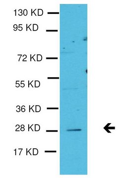 Anti-TGIF2 Antibody Upstate&#174;, from rabbit