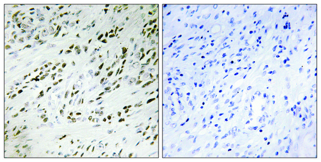 Anti-TSH2 antibody produced in rabbit affinity isolated antibody