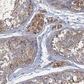 Anti-ARL11 antibody produced in rabbit Prestige Antibodies® Powered by Atlas Antibodies, affinity isolated antibody, buffered aqueous glycerol solution