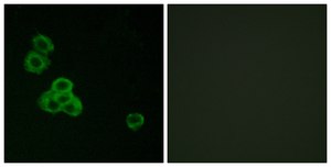 抗-CAMK2 兔抗 affinity isolated antibody