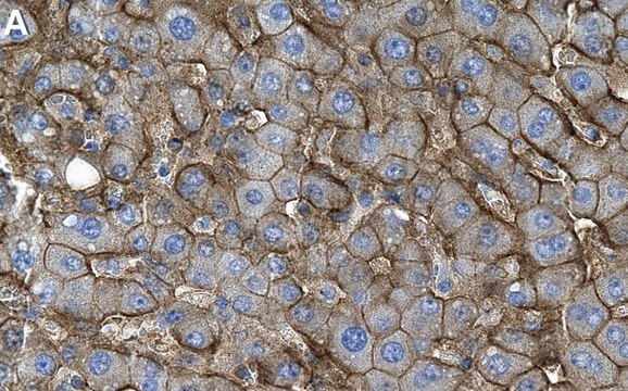 Anti-SLC13A5 Antibody, clone 1D4 ZooMAb&#174; Rabbit Monoclonal recombinant, expressed in HEK 293 cells