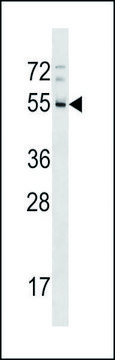 ANTI-RHD (CENTER) antibody produced in rabbit IgG fraction of antiserum, buffered aqueous solution