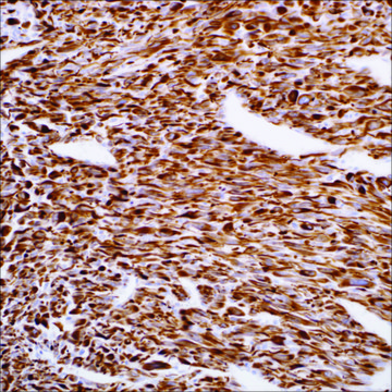 Desmin (EP15) Rabbit Monoclonal Primary Antibody