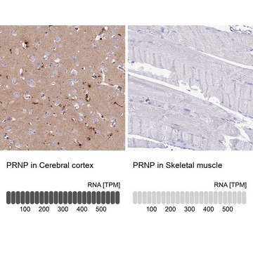 Anti-PRNP antibody produced in rabbit Prestige Antibodies&#174; Powered by Atlas Antibodies, affinity isolated antibody, buffered aqueous glycerol solution