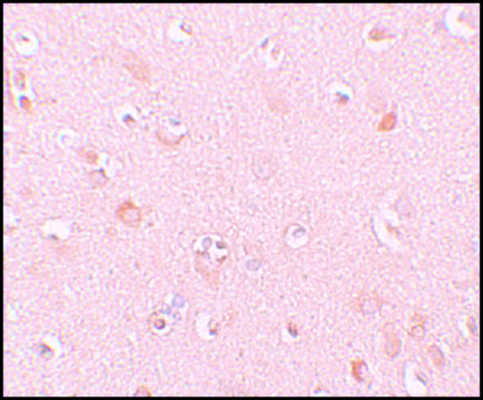 Anti-NALP5 antibody produced in rabbit affinity isolated antibody, buffered aqueous solution