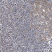 Anti-ZC3H12D antibody produced in rabbit Prestige Antibodies® Powered by Atlas Antibodies, affinity isolated antibody, buffered aqueous glycerol solution