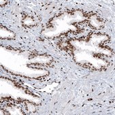 Monoclonal Anti-HIST1H2AG antibody produced in mouse Prestige Antibodies® Powered by Atlas Antibodies, clone CL5041, purified immunoglobulin, buffered aqueous glycerol solution