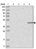 Anti-KLHDC3 antibody produced in rabbit Prestige Antibodies® Powered by Atlas Antibodies, affinity isolated antibody, buffered aqueous glycerol solution, ab3