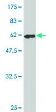 Monoclonal Anti-FVT1 antibody produced in mouse clone 2B2-3C11, purified immunoglobulin, buffered aqueous solution