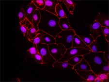 Anti-Claudin-4 (C-terminal) antibody produced in rabbit affinity isolated antibody