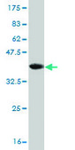 Monoclonal Anti-DAZ1 antibody produced in mouse clone 3E3, purified immunoglobulin, buffered aqueous solution