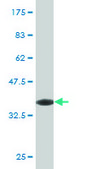 Monoclonal Anti-SNAI1 antibody produced in mouse clone 2G11, purified immunoglobulin, buffered aqueous solution