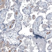 Monoclonal Anti-AFP antibody produced in mouse Prestige Antibodies® Powered by Atlas Antibodies, clone CL9766, purified immunoglobulin, buffered aqueous glycerol solution