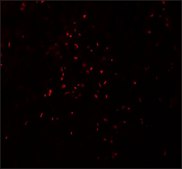 Anti-ZBTB7A antibody produced in rabbit affinity isolated antibody, buffered aqueous solution