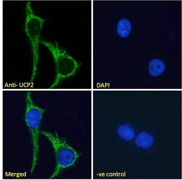 Anti-Uncoupling Protein 2/UCP2 antibody produced in goat affinity isolated antibody, buffered aqueous solution