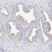 Anti-RASA2 antibody produced in rabbit Prestige Antibodies® Powered by Atlas Antibodies, affinity isolated antibody, buffered aqueous glycerol solution