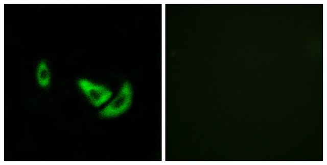 Anti-DCT antibody produced in rabbit affinity isolated antibody