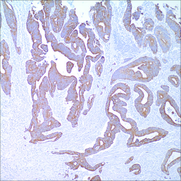 Cytokeratin 20 (Ks20.8) Mouse Monoclonal Antibody