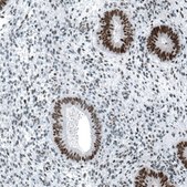 Monoclonal Anti-CHEK2 antibody produced in mouse Prestige Antibodies® Powered by Atlas Antibodies, clone CL9440, purified immunoglobulin, buffered aqueous glycerol solution