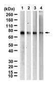 Anti-Arylsulfatase A Antibody, clone 2C19 ZooMAb® Rabbit Monoclonal recombinant, expressed in HEK 293 cells