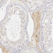 Anti-PLOD3 antibody produced in rabbit Prestige Antibodies® Powered by Atlas Antibodies, affinity isolated antibody, buffered aqueous glycerol solution
