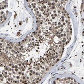 Anti-RRP1B antibody produced in rabbit Prestige Antibodies® Powered by Atlas Antibodies, affinity isolated antibody, buffered aqueous glycerol solution, Ab1