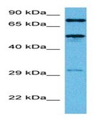 Anti-TFE3 antibody produced in rabbit affinity isolated antibody