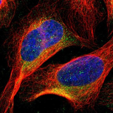 Anti-TREM2 antibody produced in rabbit Prestige Antibodies&#174; Powered by Atlas Antibodies, affinity isolated antibody, buffered aqueous glycerol solution