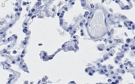 Anti-ACE2-cytoplasmic Antibody, clone 1C17 ZooMAb® Rabbit Monoclonal recombinant, expressed in HEK 293 cells