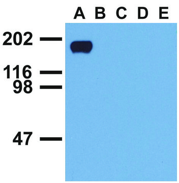 Monoclonal Anti-EGFR (PhosphoTyr992) antibody produced in mouse clone EM-12