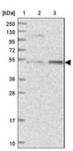 Anti-DDX49 antibody produced in rabbit Prestige Antibodies® Powered by Atlas Antibodies, affinity isolated antibody, buffered aqueous glycerol solution
