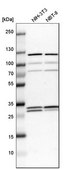 Anti-ETFB antibody produced in rabbit Prestige Antibodies® Powered by Atlas Antibodies, affinity isolated antibody, buffered aqueous glycerol solution, Ab2