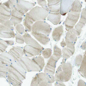 Anti-FGF1 antibody produced in rabbit Prestige Antibodies® Powered by Atlas Antibodies, affinity isolated antibody, buffered aqueous glycerol solution
