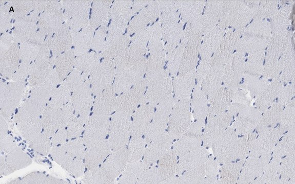 Anti-alpha Actinin 2 Antibody, clone 1E11, ZooMAb&#174; Rabbit Monoclonal recombinant, expressed in HEK 293 cells