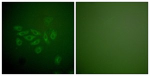 Anti-FHIT antibody produced in rabbit affinity isolated antibody