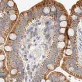 Anti-HDHD3 antibody produced in rabbit Prestige Antibodies® Powered by Atlas Antibodies, affinity isolated antibody, buffered aqueous glycerol solution, Ab3