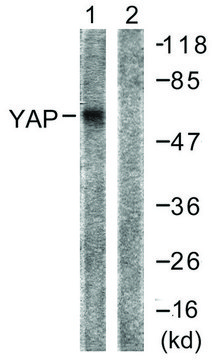 Anti-YAP antibody produced in rabbit affinity isolated antibody