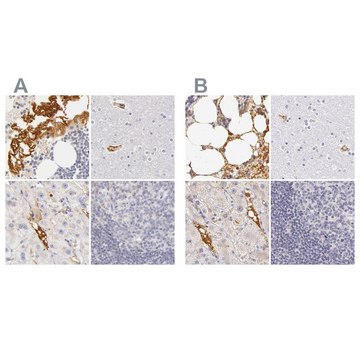 Anti-AHSG antibody produced in rabbit Prestige Antibodies&#174; Powered by Atlas Antibodies, affinity isolated antibody, buffered aqueous glycerol solution