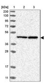 Anti-RPF1 antibody produced in rabbit Prestige Antibodies® Powered by Atlas Antibodies, affinity isolated antibody, buffered aqueous glycerol solution