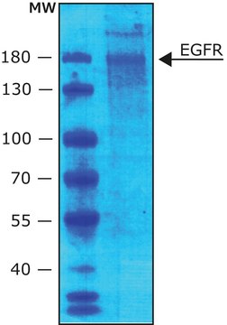 Epidermal Growth Factor Receptor human buffered aqueous glycerol solution, 5,000-30,000&#160;units/mg protein (Lowry)