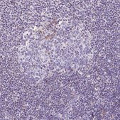 Anti-ETNK2 antibody produced in rabbit Prestige Antibodies® Powered by Atlas Antibodies, affinity isolated antibody, buffered aqueous glycerol solution