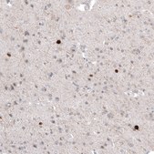 Anti-CALB2 antibody produced in mouse Prestige Antibodies® Powered by Atlas Antibodies, clone CL12836, purified by using Protein A, buffered aqueous glycerol solution