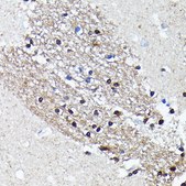 Anti-NMDAR2A antibody produced in rabbit