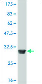 ANTI-FOXL1 antibody produced in mouse clone 2E6, purified immunoglobulin, buffered aqueous solution